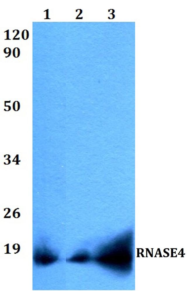 RNASE4 Antibody in Western Blot (WB)