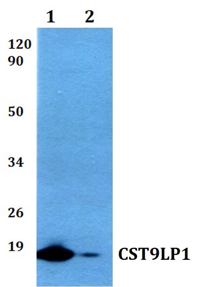 CST9LP1 Antibody in Western Blot (WB)