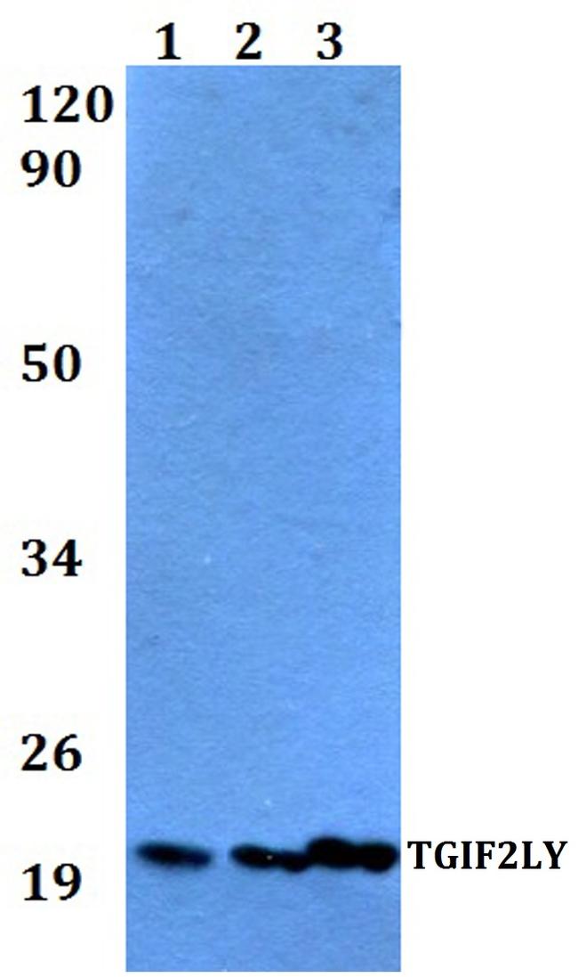 TGIF2LY Antibody in Western Blot (WB)