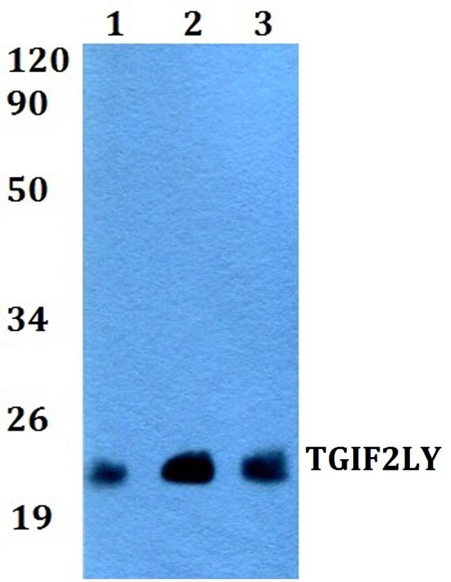 TGIF2LY Antibody in Western Blot (WB)