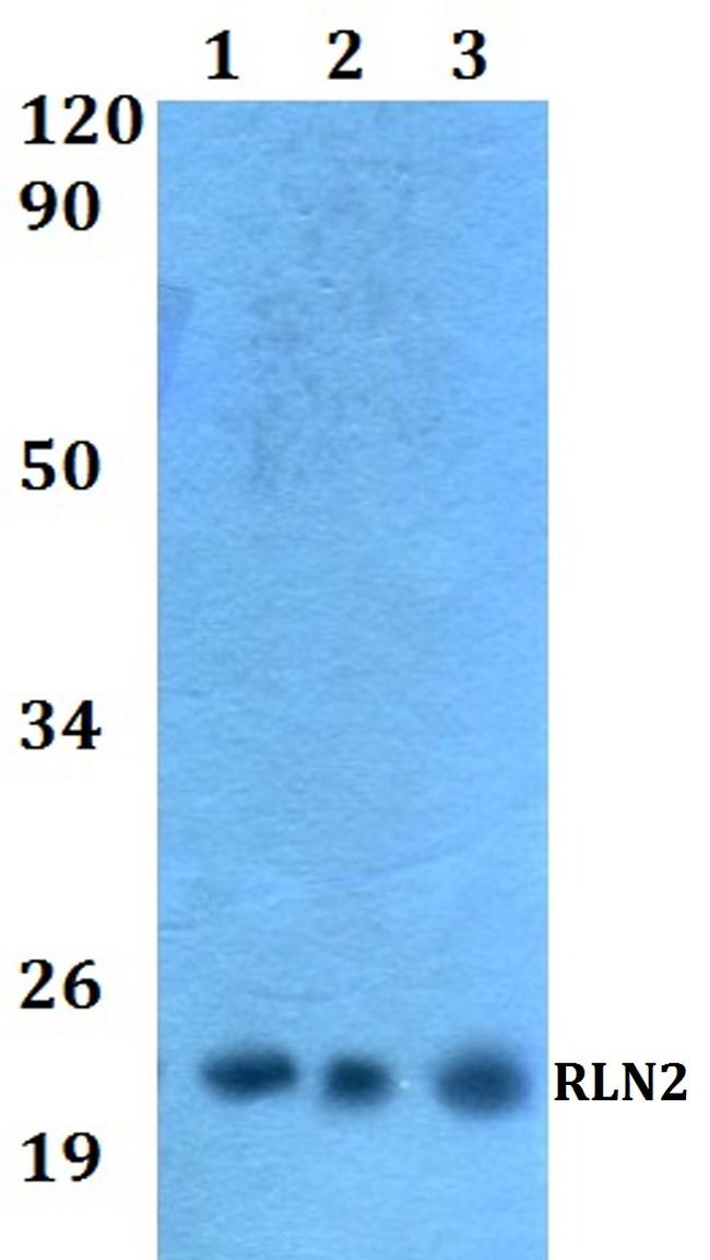 Relaxin 2 Antibody in Western Blot (WB)