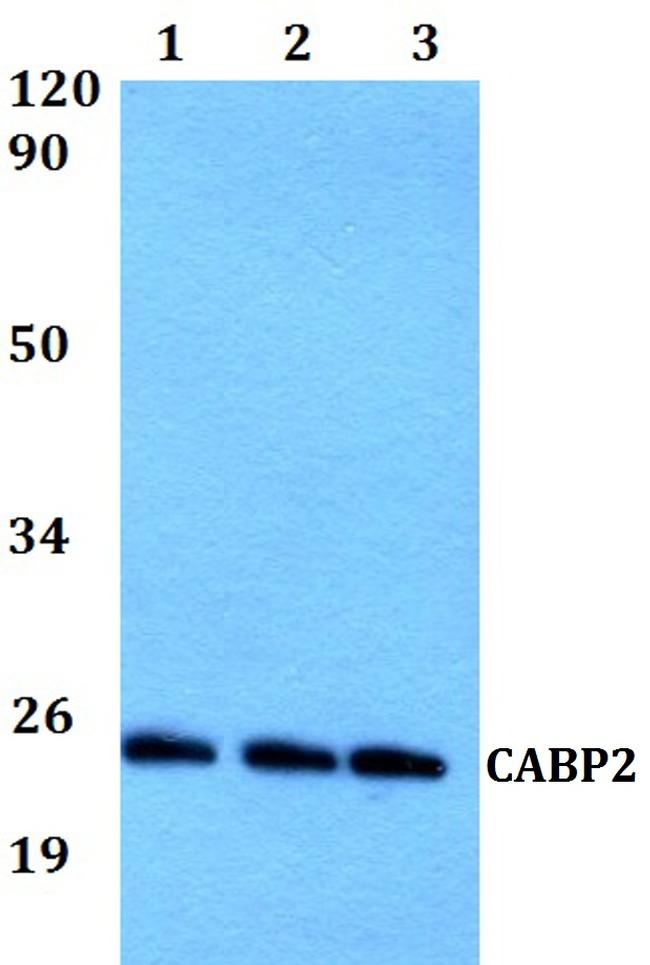 CABP2 Antibody in Western Blot (WB)