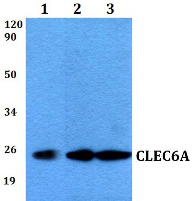 Dectin 2 Antibody in Western Blot (WB)