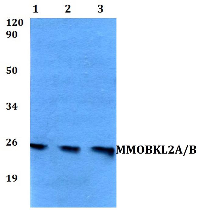 MOB3A/MOB3B Antibody in Western Blot (WB)