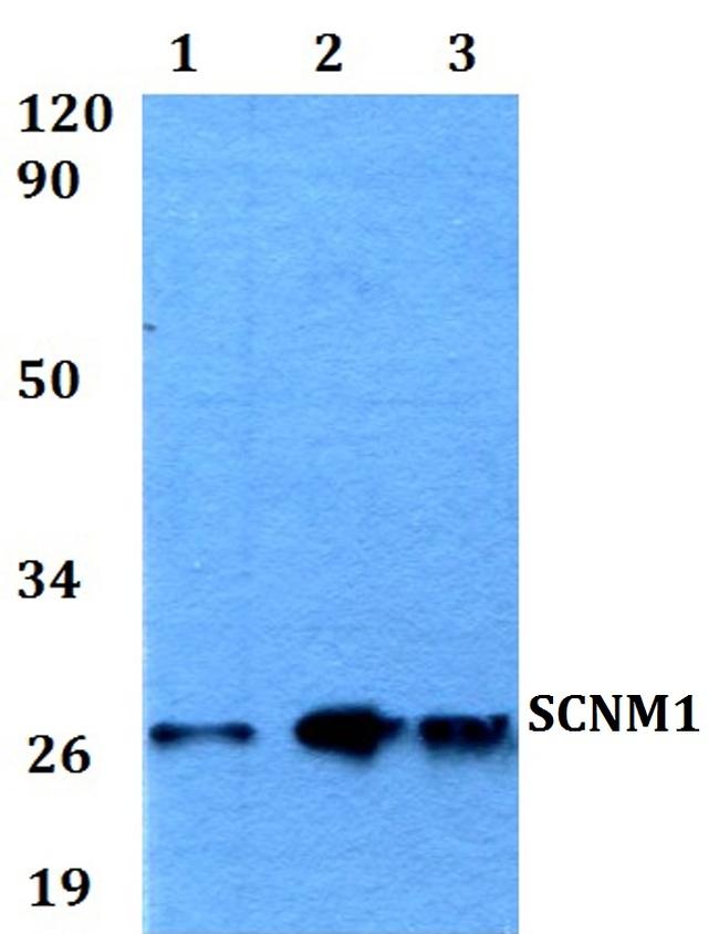 SCNM1 Antibody in Western Blot (WB)