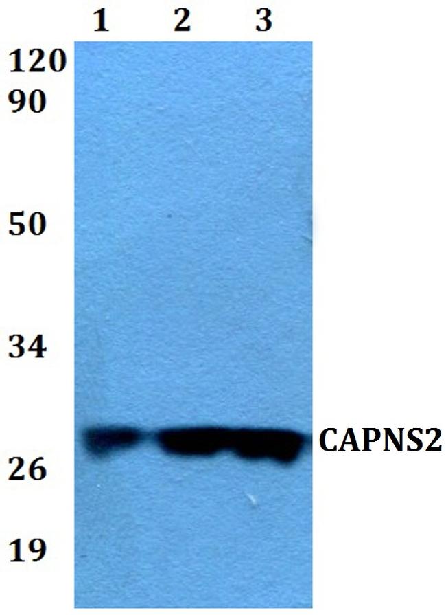 CAPNS2 Antibody in Western Blot (WB)