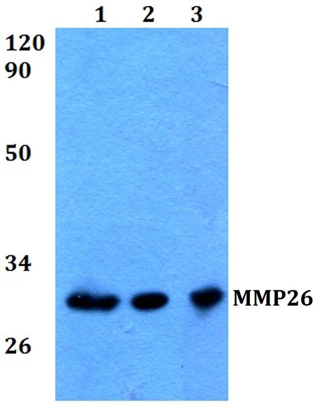 MMP26 Antibody in Western Blot (WB)