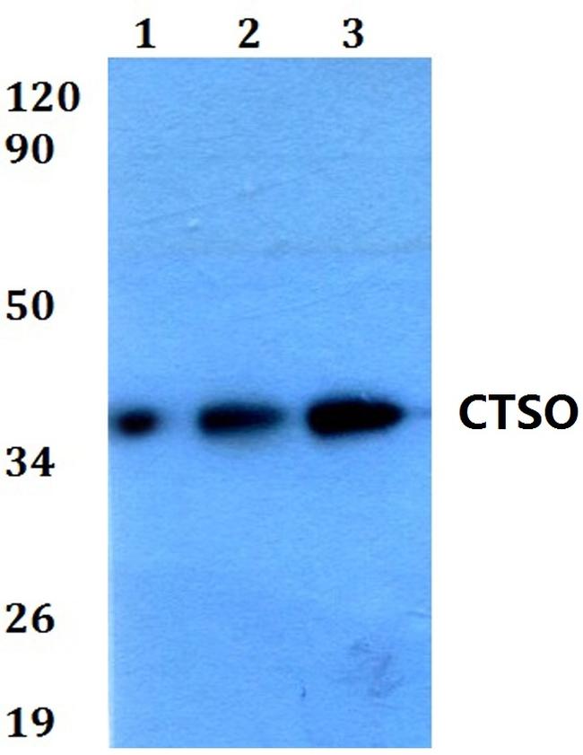 Cathepsin O Antibody in Western Blot (WB)