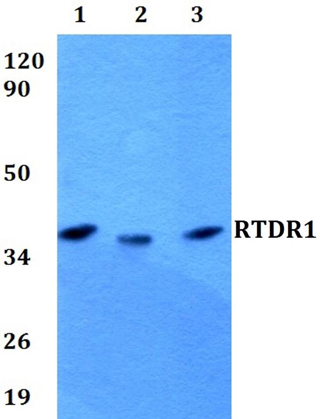 RTDR1 Antibody in Western Blot (WB)