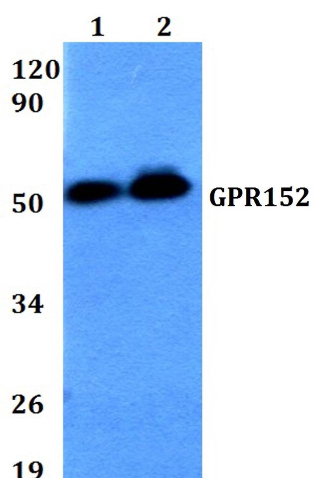 GPR152 Antibody in Western Blot (WB)