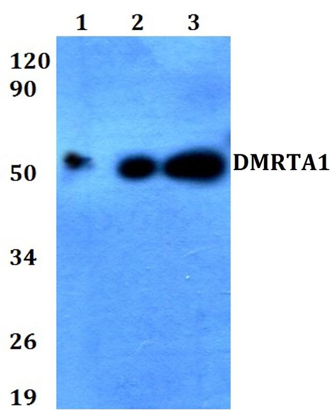DMRTA1 Antibody in Western Blot (WB)