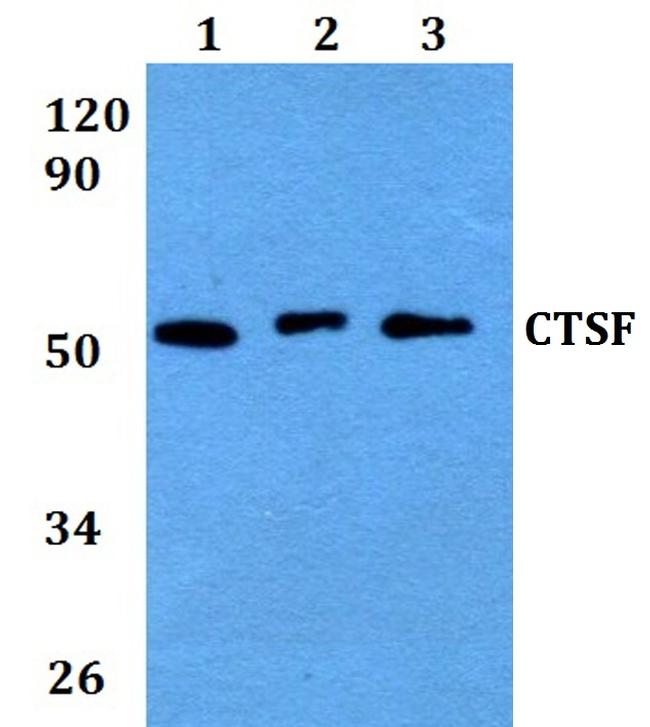 Cathepsin F Antibody in Western Blot (WB)
