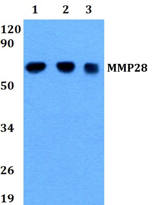 MMP28 Antibody in Western Blot (WB)
