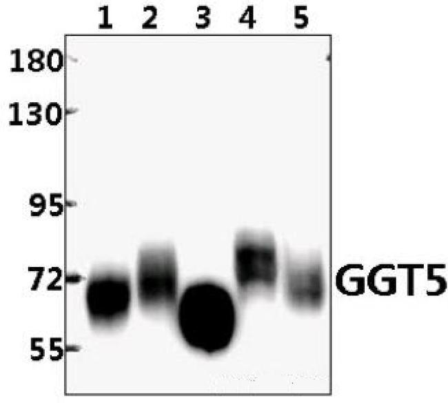 GGT5 Antibody in Western Blot (WB)
