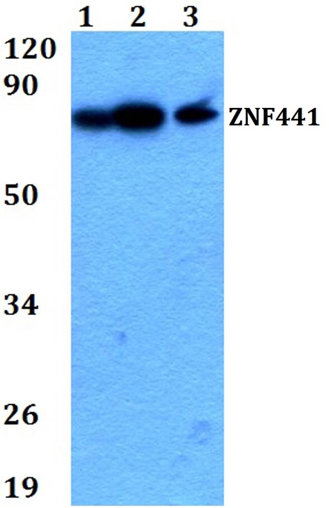 ZNF441 Antibody in Western Blot (WB)