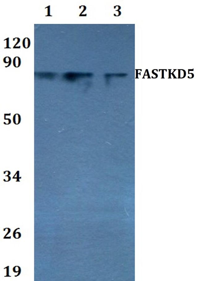 FASTKD5 Antibody in Western Blot (WB)