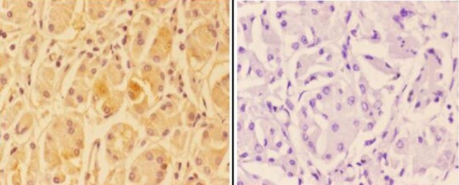 A20A3 Antibody in Immunohistochemistry (Paraffin) (IHC (P))