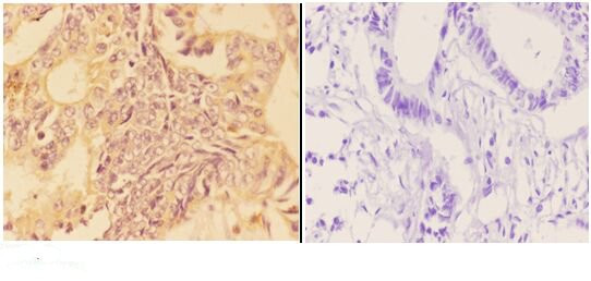 APOB48R Antibody in Immunohistochemistry (Paraffin) (IHC (P))