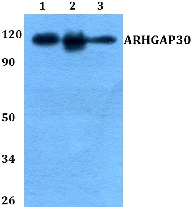 ARHGAP30 Antibody in Western Blot (WB)