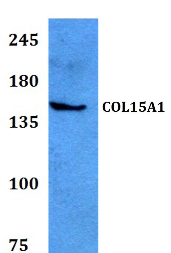 COL15A1 Antibody in Western Blot (WB)