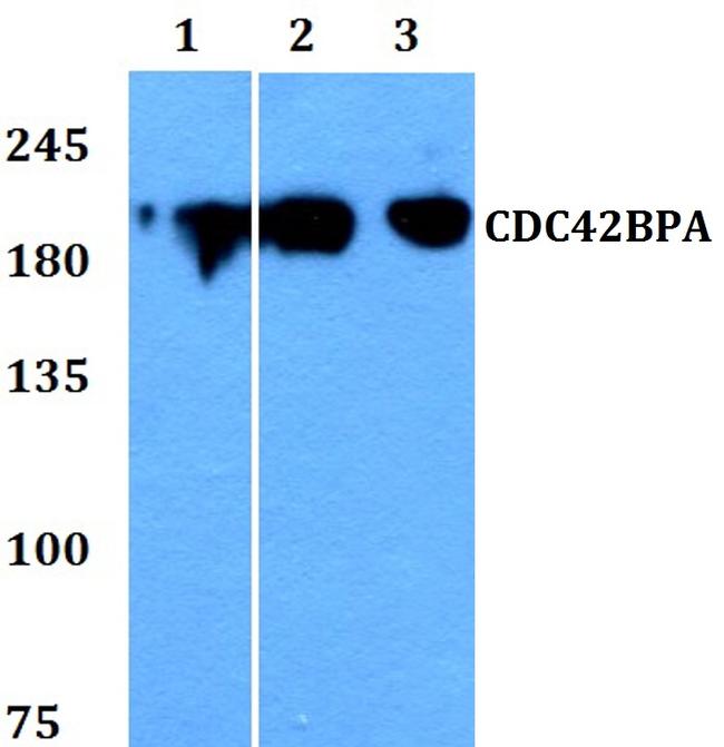 MRCK alpha Antibody in Western Blot (WB)