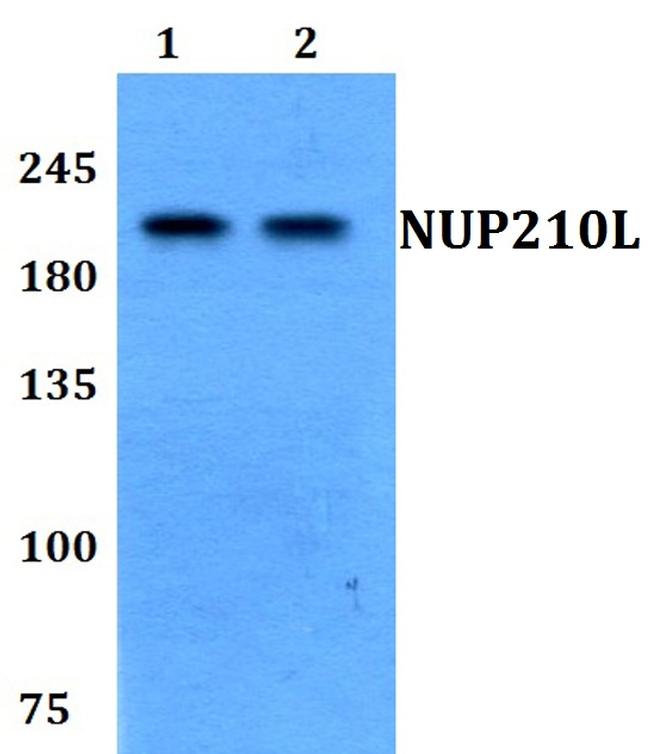 NUP210L Antibody in Western Blot (WB)