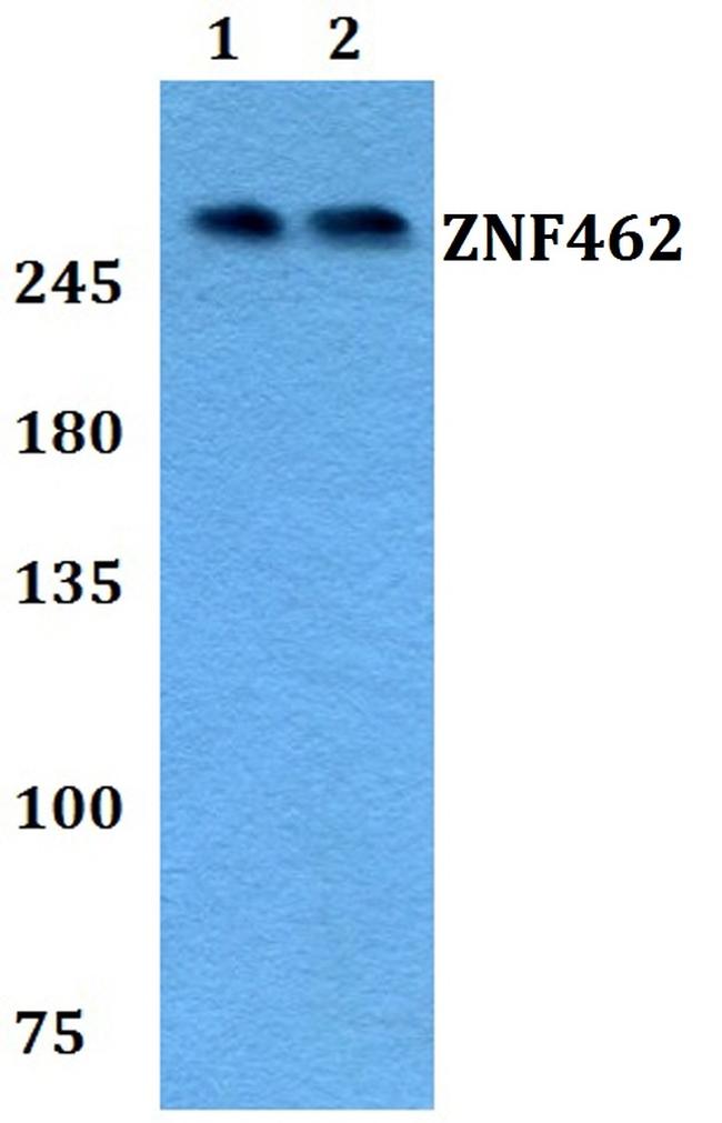 ZNF462 Antibody in Western Blot (WB)