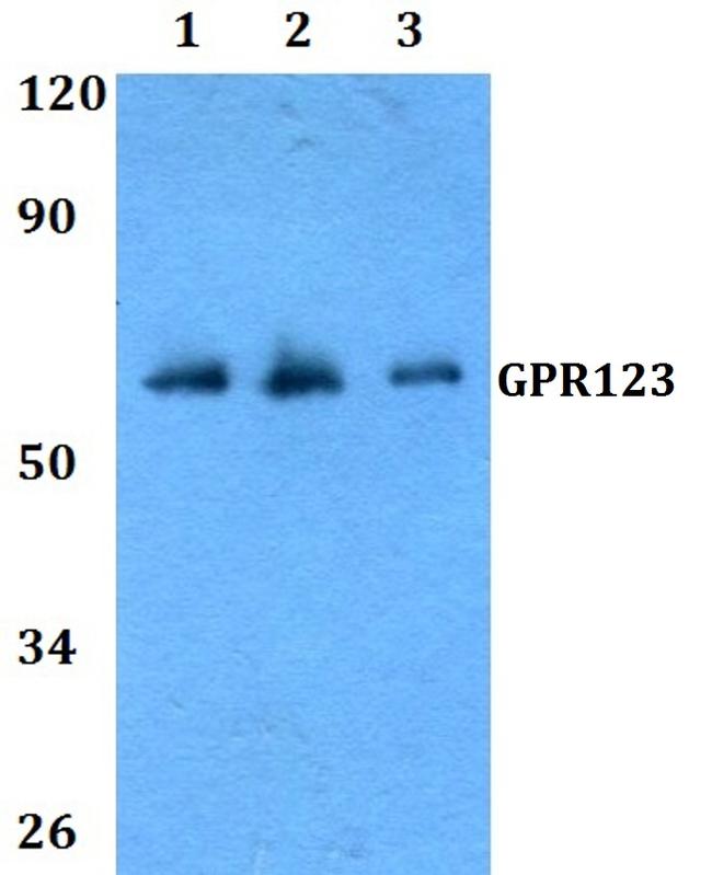 GPR123 Antibody in Western Blot (WB)