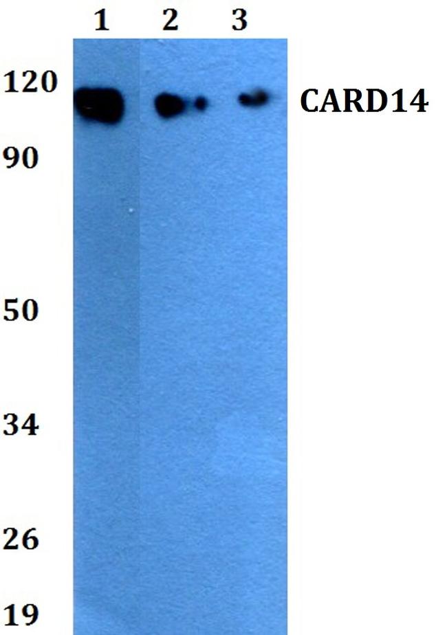 CARD14 Antibody in Western Blot (WB)