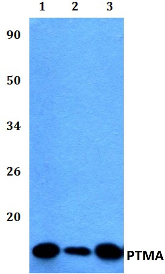 PTMA Antibody in Western Blot (WB)