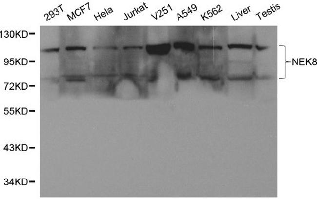NEK8 Antibody in Western Blot (WB)