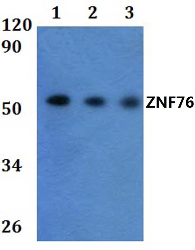 ZNF76 Antibody in Western Blot (WB)