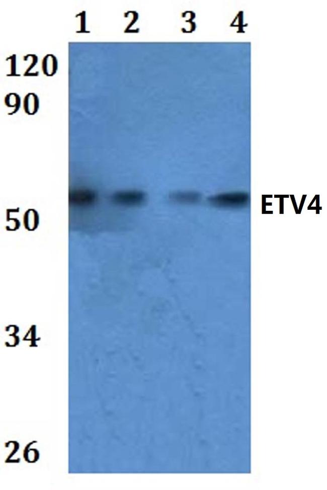 ETV4 Antibody in Western Blot (WB)
