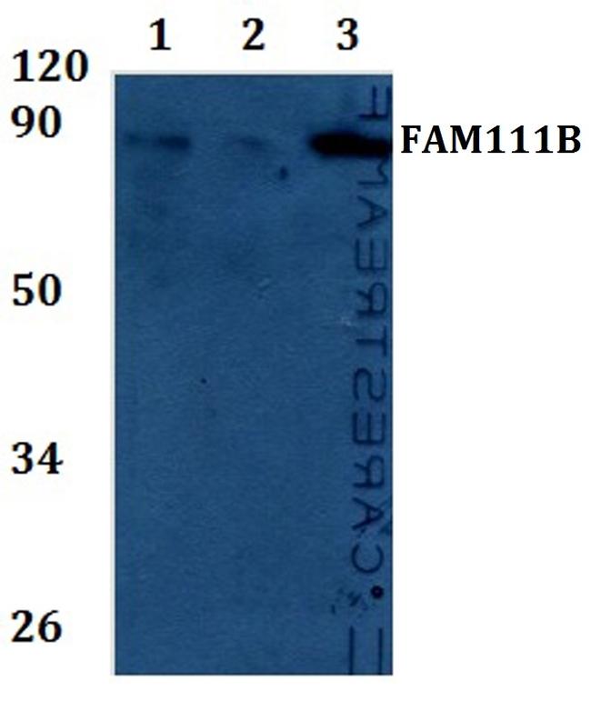 FAM111B Antibody in Western Blot (WB)
