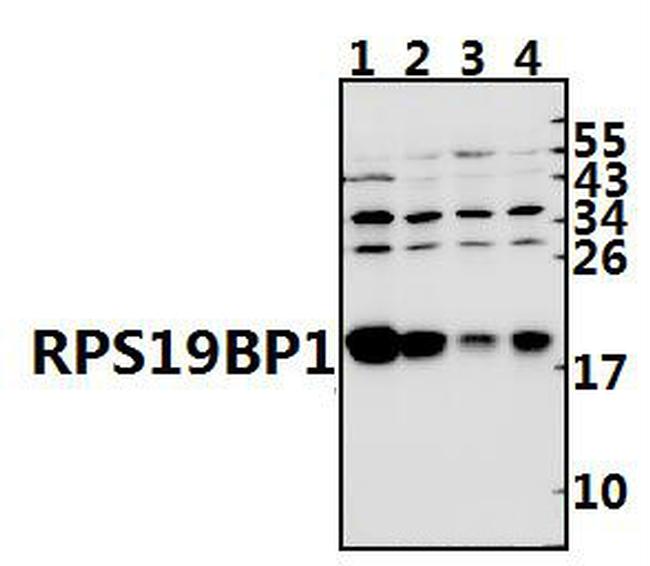 AROS Antibody in Western Blot (WB)