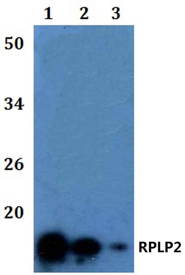 RPLP2 Antibody in Western Blot (WB)