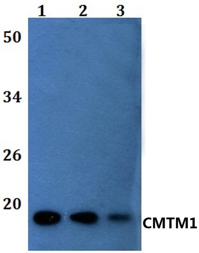 CMTM1 Antibody in Western Blot (WB)