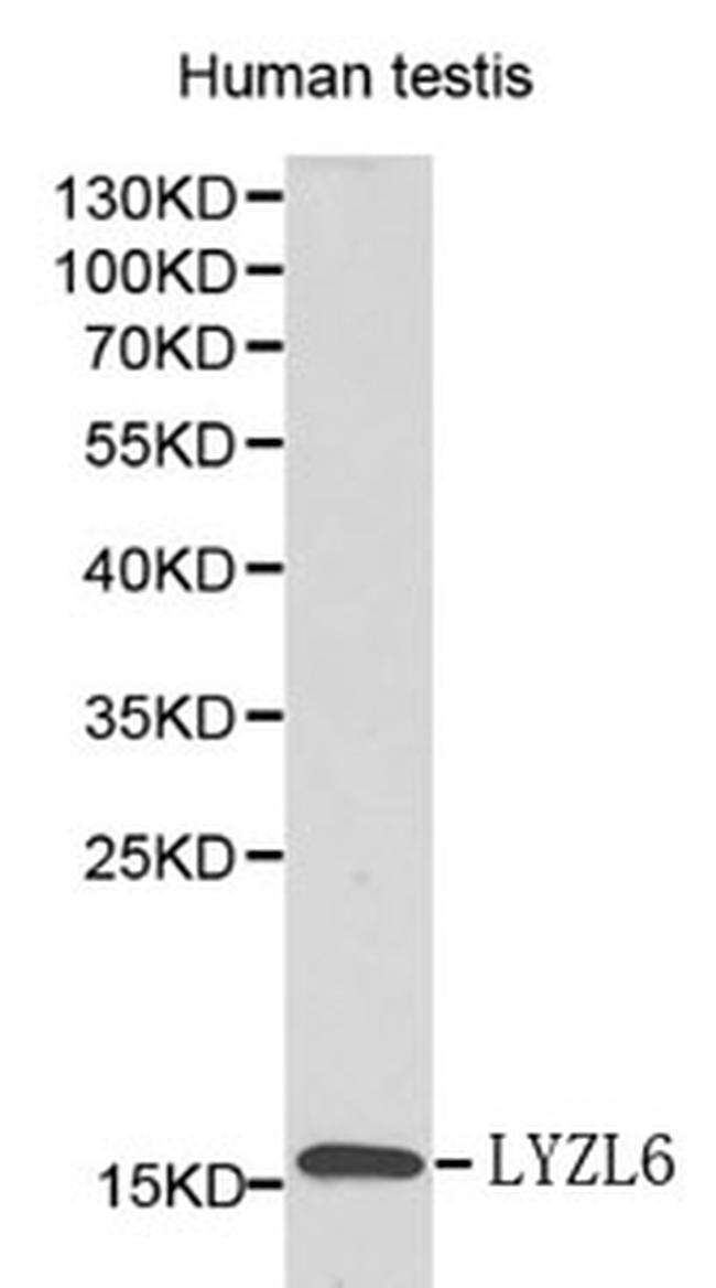 LYZL6 Antibody in Western Blot (WB)