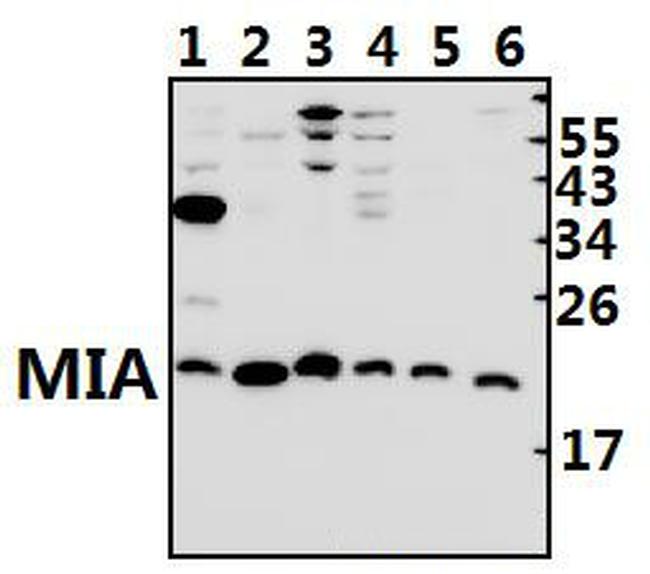 MIA Antibody in Western Blot (WB)