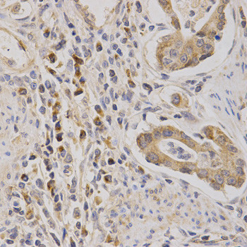 ARPC1A Antibody in Immunohistochemistry (Paraffin) (IHC (P))