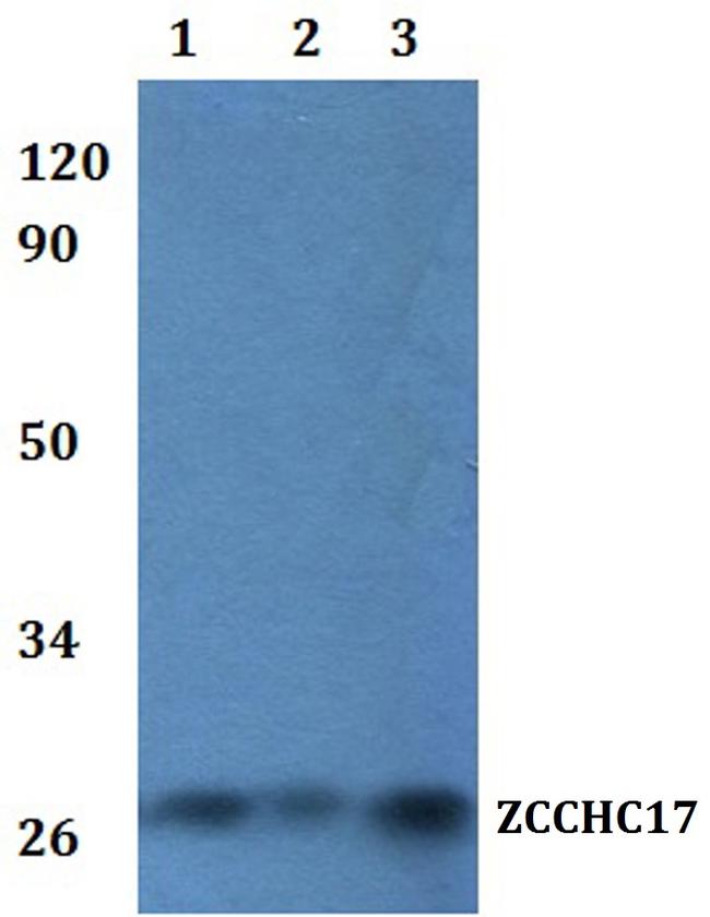 ZCCHC17 Antibody in Western Blot (WB)
