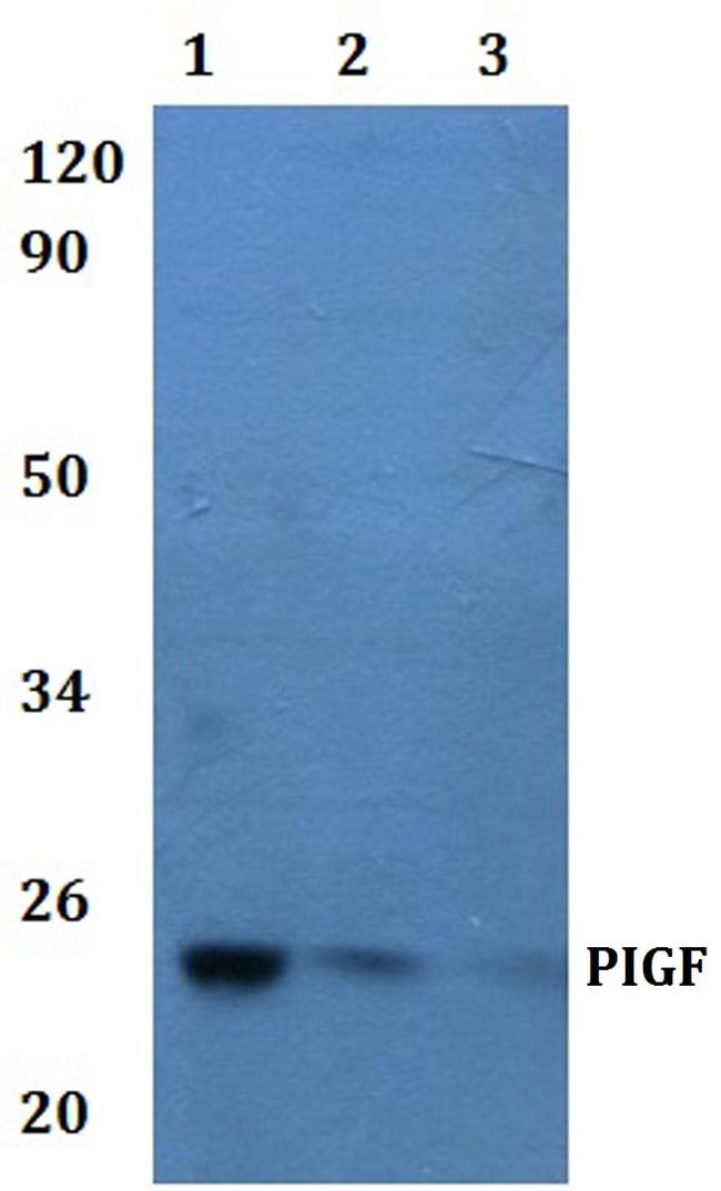 PIGF Antibody in Western Blot (WB)