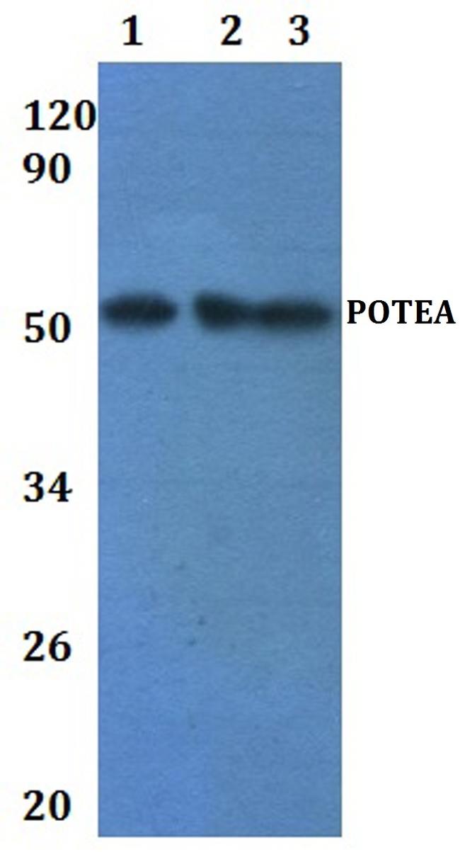 POTEA Antibody in Western Blot (WB)