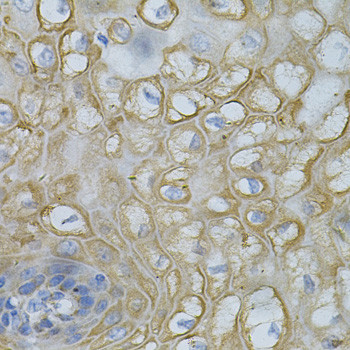 DEFB132 Antibody in Immunohistochemistry (Paraffin) (IHC (P))
