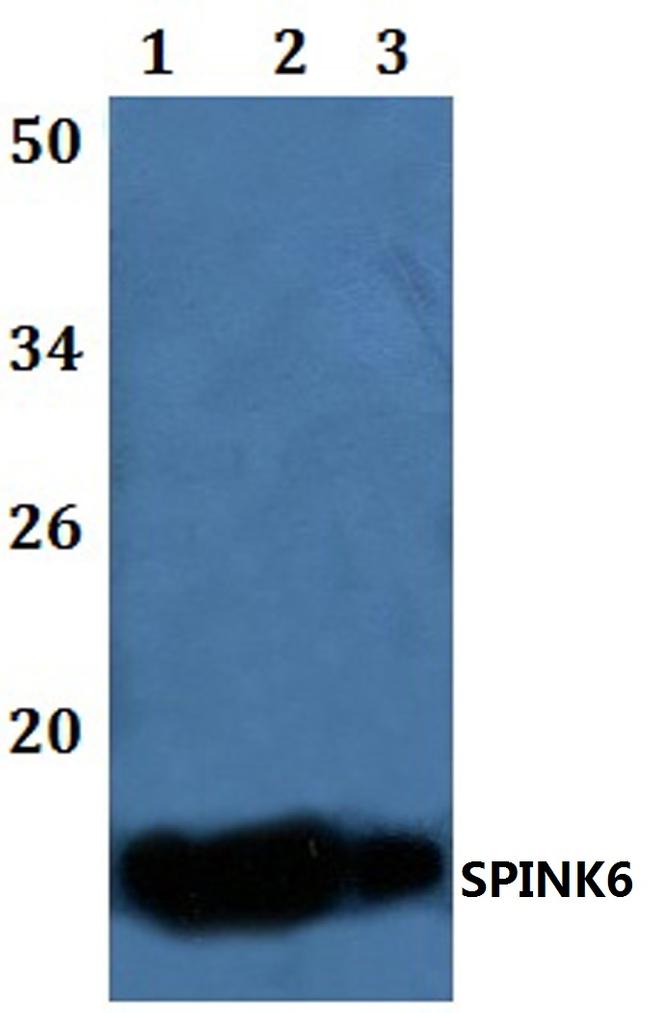 SPINK6 Antibody in Western Blot (WB)