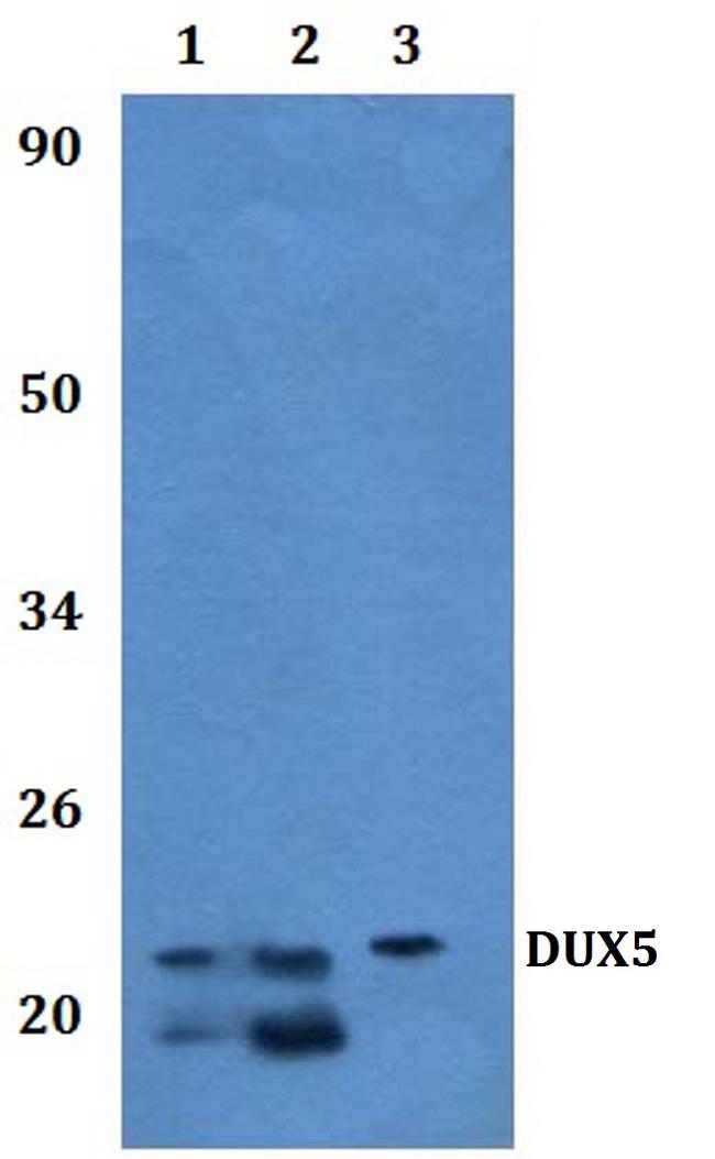 DUX5 Antibody in Western Blot (WB)