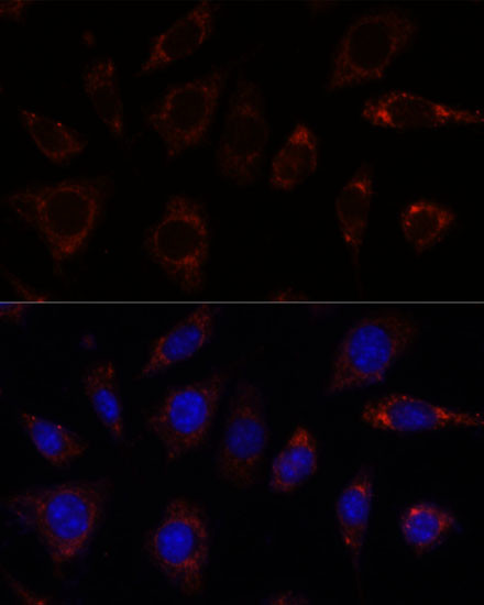 TBRG4 Antibody in Immunocytochemistry (ICC/IF)