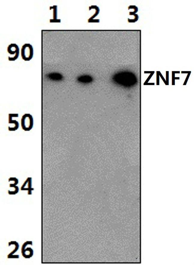ZNF7 Antibody in Western Blot (WB)