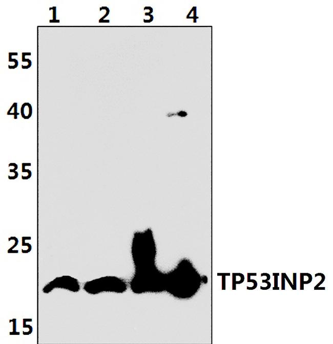TP53INP2 Antibody in Western Blot (WB)