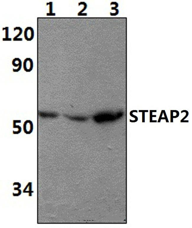 STEAP2 Antibody in Western Blot (WB)